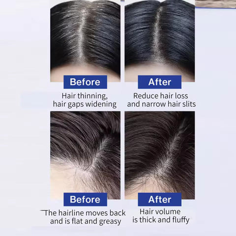 FEG Hair Care Spray Serum For Hair Loss 50ml