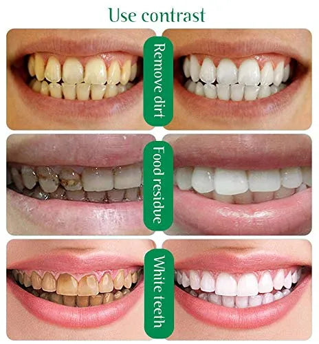 Charcoal Teeth Whitening Powder Pure Natural 60 Ml ✨🦷